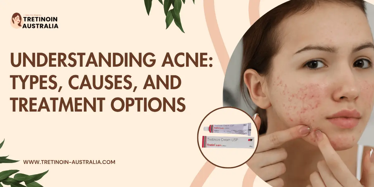 Tretinoin blogs image here